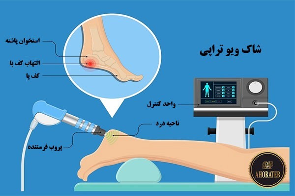 تعمیرات دستگاه های شاک ویو-اهورا طب تجهیز گستر